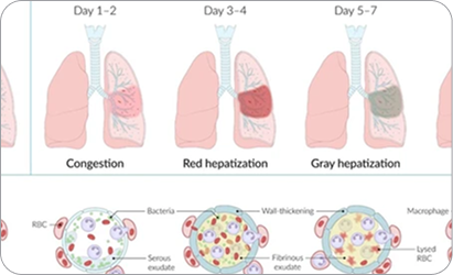 Mechanisms of Lobar Pneumonia